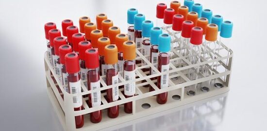 Rozbor možností a využití Red Hat Linuxu